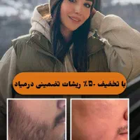 رویش ریش و سبیل