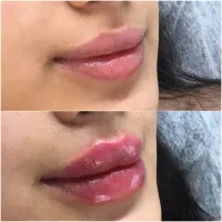 خدمات فیلر و بوتاکس و ماساژ
