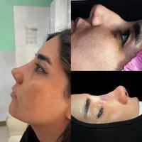 عمل بینی فقط۱۷ کلینیک +جراحی +بیهوشی|خدمات آرایشگری و زیبایی|تهران, زعفرانیه|دیوار