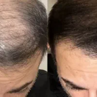 بدون درد و خونریزی برات درشون میارم