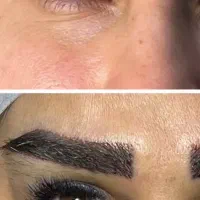اسپارتینا ،بلفارو،ساکشن غبغب،لیپوابدو کلینیک اقساط