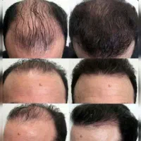 حواست به موهات نباشه باخت دادی