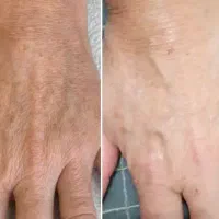 پاک کننده لکه