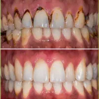 جرم گیری رایگان برای همه
