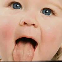 آموزش رایگان طب.تشخیص از روی زبان کف دست.حجامت.فصد