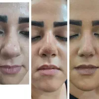 اف ویژه
