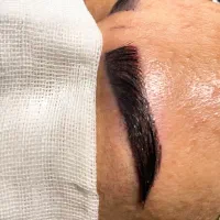 کاشت ابرو تخصصی