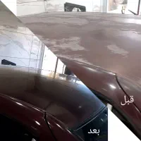 رفع آفتاب سوختگی