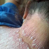 از شرش خلاص شو