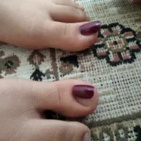 کاشت ناخن پا با تخصص ۱۰ ساله