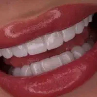 لمینت|خدمات رایانهای و موبایل|ایلام, |دیوار