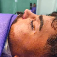 جراحی بینی با شرایط ویژه در تهران