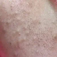 فشیال پاکسازی پوست تخفیف ویژه