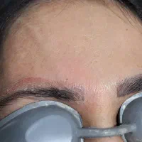 پاک کردن انواع تتو،ابرو.خط چشم،صورت و بدن
