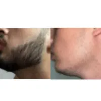 محصولات رویش و پرپشتی ریش