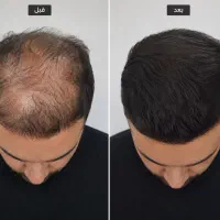ببینید از چی به چی رسید