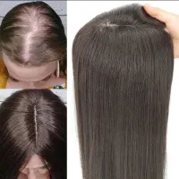 مدل اقا و خانم برای عکاسی کاشت مو و پروتز مو