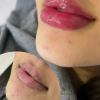 جذب نیرو درمطب پزشکی