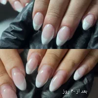 کاشت و ترمیم ناخن ، آموزش