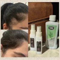 تونیک ضد ریزش مو گیاهی