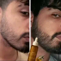تقویت وپرپشتی ریش ومو