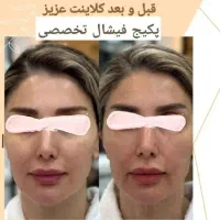 تخفیف خدمات فیشال تخصصی و پاکسازی
