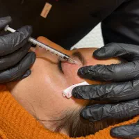 فیلر، بوتاکس، مزوتراپی و خدمات پوست و مو توسط پزشک