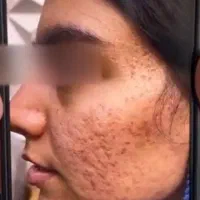 اولین مرکز تخصصی اسکار در کوهدشت