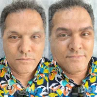 میکروبلیدینگ ابرو استایل آقایان
