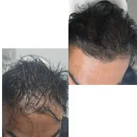 آموزش وخدمات زیبایی پوست و مو با جدیدترین تکنیک ها