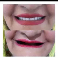 دندانسازی     بابک. لبخند زیبا