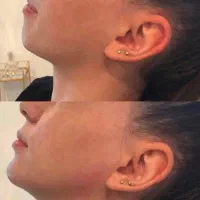 بهترین خدمات زیبایی ژل بوتاکس فیلر مزوژل لیزر|خدمات زیبایی و سلامت|شیراز, ارم|دیوار