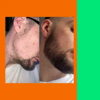 توهم دنبال ریش پر پشت مرتبی