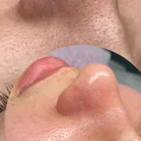 فیشیال و پاکسازی تخصصی در فسا، بلوار دکتر دوگانی