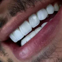 جشنواره لمینت و کامپوزیت
