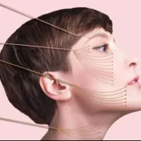 بهترین مرکز تخصصی لیفت صورت با نخ در شیراز اقساطی