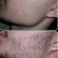 ریشات اینجاس
