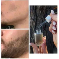۲۸ روزه تکمیل کن ریش و موهاتو