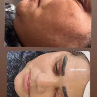 فیشال روشن سازی پوست و فیشال عروس
