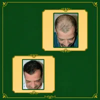 ریشت رو جدی بگیر تا موقعی که دیر نشده
