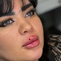 تزریق ژل و بوتاکس وآموزش تخصصی