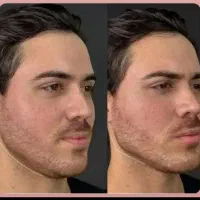 بدون جراحی زیبا شوید تغییر سریع