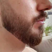 چسب ریش ممنوع