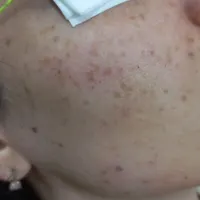 مرکز لاغری تضمینی بادستگاه کرایولیپولیز|خدمات آرایشگری و زیبایی|رشت, پیرسرا|دیوار