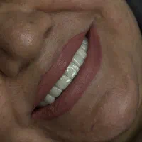 نیازمند دستیار دندانپزشک  با سابقه