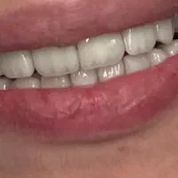 استخدام مدل برای محتوای دندانپزشکی