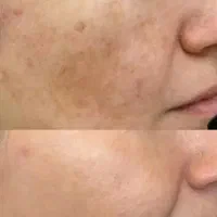 کرم روشن کننده ۸ کاره گاتیو (پرداخت درب منزل)
