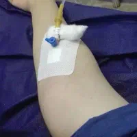 تزریقات در منزل