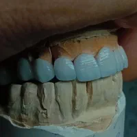 استخدام و کارآموزی (لابراتوار دندانسازی )