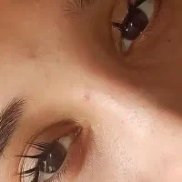 کاشت مژه هیدن